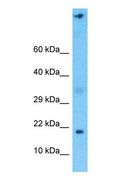 NDUFA6 Antibody - Western blot of NDUFA6 Antibody with human 293T Whole Cell lysate.  This image was taken for the unconjugated form of this product. Other forms have not been tested.