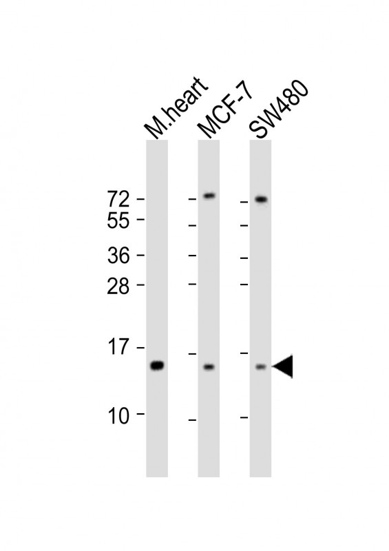NDUFA7 Antibody - All lanes: Anti-NDUFA7 Antibody (C-Term) at 1:2000 dilution. Lane 1: mouse heart lysate. Lane 2: MCF-7 whole cell lysate. Lane 3: SW480 whole cell lysate Lysates/proteins at 20 ug per lane. Secondary Goat Anti-Rabbit IgG, (H+L), Peroxidase conjugated at 1:10000 dilution. Predicted band size: 13 kDa. Blocking/Dilution buffer: 5% NFDM/TBST.