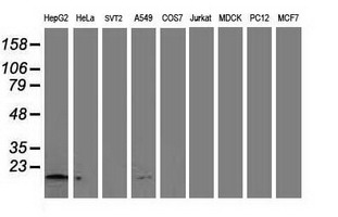 NDUFA7 Antibody - Western blot of extracts (35 ug) from 9 different cell lines by using anti-NDUFA7 monoclonal antibody.