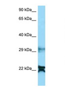 NDUFA8 Antibody - NDUFA8 antibody Western blot of COL0205 Cell lysate. Antibody concentration 1 ug/ml.  This image was taken for the unconjugated form of this product. Other forms have not been tested.