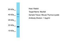 NDUFA8 Antibody -  This image was taken for the unconjugated form of this product. Other forms have not been tested.