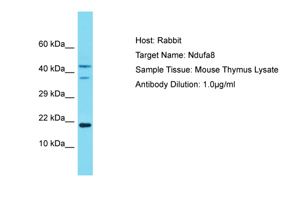 NDUFA8 Antibody -  This image was taken for the unconjugated form of this product. Other forms have not been tested.