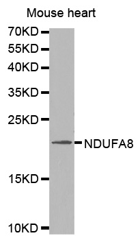 NDUFA8 Antibody - Western blot analysis of extracts of mouse heart, using NDUFA8 antibody. The secondary antibody used was an HRP Goat Anti-Rabbit IgG (H+L) at 1:10000 dilution. Lysates were loaded 25ug per lane and 3% nonfat dry milk in TBST was used for blocking.