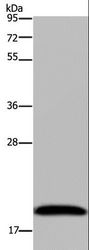 NDUFA8 Antibody - Western blot analysis of 293T cell, using NDUFA8 Polyclonal Antibody at dilution of 1:300.