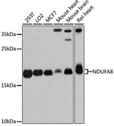 NDUFA8 Antibody - Western blot analysis of extracts of various cell lines, using NDUFA8 antibody at 1:3000 dilution. The secondary antibody used was an HRP Goat Anti-Rabbit IgG (H+L) at 1:10000 dilution. Lysates were loaded 25ug per lane and 3% nonfat dry milk in TBST was used for blocking. An ECL Kit was used for detection and the exposure time was 30s.