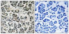 NDUFA8 Antibody - Peptide - + Immunohistochemistry analysis of paraffin-embedded human pancreas tissue using NDUFA8 antibody.