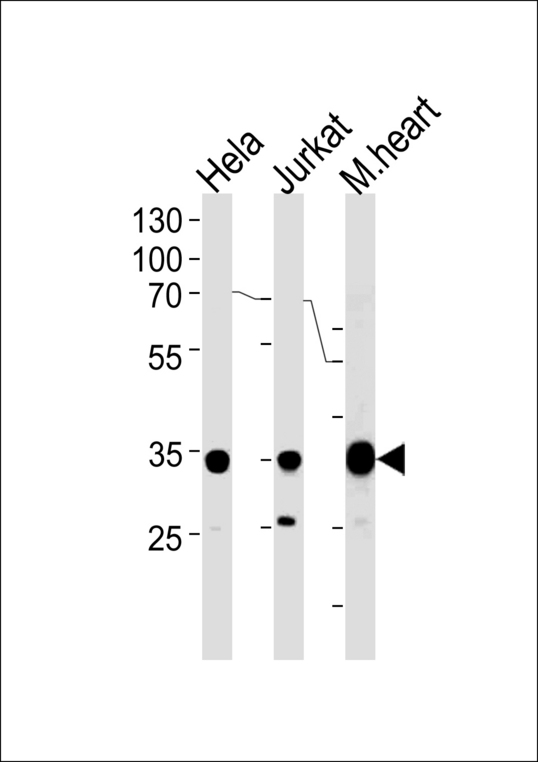 NDUFA9 Antibody - NDUFA9 Antibody western blot of HeLa, Jurkat cell line and mouse heart tissue lysates (35 ug/lane). The NDUFA9 antibody detected the NDUFA9 protein (arrow).