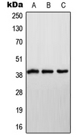 NDUFA9 Antibody - Western blot analysis of NDUFA9 expression in HeLa (A); SP2/0 (B); H9C2 (C) whole cell lysates.
