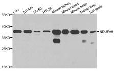 NDUFA9 Antibody - Western blot analysis of extracts of various cells.