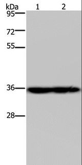 NDUFA9 Antibody - Western blot analysis of Mouse heart and kidney tissue, using NDUFA9 Polyclonal Antibody at dilution of 1:400.
