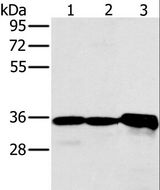 NDUFA9 Antibody - Western blot analysis of Mouse kidney tissue and Jurkat cell, mouse heart tissue, using NDUFA9 Polyclonal Antibody at dilution of 1:400.