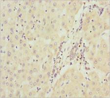 NDUFA9 Antibody - Immunohistochemistry of paraffin-embedded human liver cancer at dilution 1:100