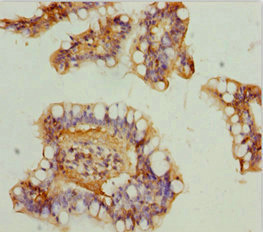 NDUFA9 Antibody - Immunohistochemistry of paraffin-embedded human small intestine tissue at dilution 1:100