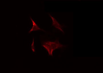 NDUFA9 Antibody - Staining HeLa cells by IF/ICC. The samples were fixed with PFA and permeabilized in 0.1% Triton X-100, then blocked in 10% serum for 45 min at 25°C. The primary antibody was diluted at 1:200 and incubated with the sample for 1 hour at 37°C. An Alexa Fluor 594 conjugated goat anti-rabbit IgG (H+L) Ab, diluted at 1/600, was used as the secondary antibody.