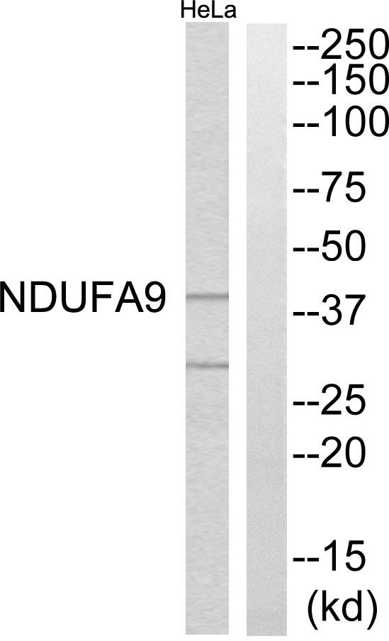 NDUFA9 Antibody - Western blot analysis of extracts from HeLa cells, using NDUFA9 antibody.