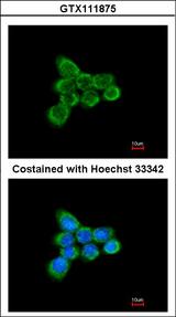 NDUFAB1 / ACP Antibody - Immunofluorescence of methanol-fixed A431 using NDUFAB1 antibody at 1:200 dilution.