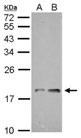 NDUFAB1 / ACP Antibody - NDUFAB1 antibody detects NDUFAB1 protein by Western blot analysis. A. 30 ug GL261 whole cell lysate/extract. B. 30 ug C8D30 whole cell lysate/extract. 12 % SDS-PAGE. NDUFAB1 antibody dilution:1:5000
