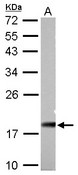 NDUFAB1 / ACP Antibody - NDUFAB1 antibody detects NDUFAB1 protein by Western blot analysis. A. 30 ug PC-12 whole cell lysate/extract. 12 % SDS-PAGE. NDUFAB1 antibody dilution:1:5000