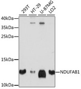 NDUFAB1 / ACP Antibody - Western blot analysis of extracts of various cell lines, using NDUFAB1 antibody at 1:1000 dilution. The secondary antibody used was an HRP Goat Anti-Rabbit IgG (H+L) at 1:10000 dilution. Lysates were loaded 25ug per lane and 3% nonfat dry milk in TBST was used for blocking. An ECL Kit was used for detection and the exposure time was 90s.