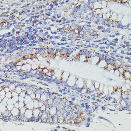 NDUFAB1 / ACP Antibody - Immunohistochemistry of paraffin-embedded Human colon using NDUFAB1 Polyclonal Antibody at dilution of 1:100 (40x lens).