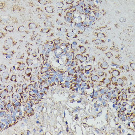 NDUFAB1 / ACP Antibody - Immunohistochemistry of paraffin-embedded Human esophageal using NDUFAB1 Polyclonal Antibody at dilution of 1:100 (40x lens).