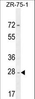 NDUFAF1 / CIA30 Antibody - NDUFAF1 Antibody western blot of ZR-75-1 cell line lysates (35 ug/lane). The NDUFAF1 antibody detected the NDUFAF1 protein (arrow).