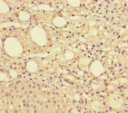 NDUFAF1 / CIA30 Antibody - Immunohistochemistry of paraffin-embedded human adrenal gland tissue using NDUFAF1 Antibody at dilution of 1:100