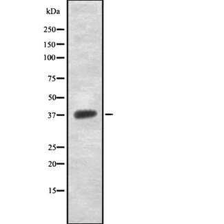NDUFAF1 / CIA30 Antibody - Western blot analysis of NDUFAF1 using Jurkat whole lysates.