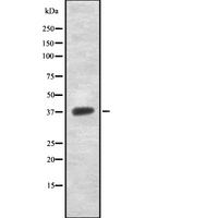 NDUFAF1 / CIA30 Antibody - Western blot analysis of NDUFAF1 using Jurkat whole lysates.