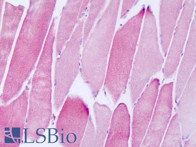 NDUFAF2 / NDUFA12L Antibody - Anti-NDUFAF2 / NDUFA12L antibody IHC of human skeletal muscle. Immunohistochemistry of formalin-fixed, paraffin-embedded tissue after heat-induced antigen retrieval. Antibody dilution 5-10 ug/ml. This image was taken for the unconjugated form of this product. Other forms have not been tested.