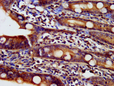 NDUFAF2 / NDUFA12L Antibody - Immunohistochemistry image at a dilution of 1:500 and staining in paraffin-embedded human small intestine tissue performed on a Leica BondTM system. After dewaxing and hydration, antigen retrieval was mediated by high pressure in a citrate buffer (pH 6.0) . Section was blocked with 10% normal goat serum 30min at RT. Then primary antibody (1% BSA) was incubated at 4 °C overnight. The primary is detected by a biotinylated secondary antibody and visualized using an HRP conjugated SP system.