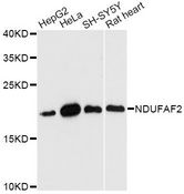 NDUFAF2 / NDUFA12L Antibody - Western blot analysis of extracts of various cell lines, using NDUFAF2 antibody at 1:3000 dilution. The secondary antibody used was an HRP Goat Anti-Rabbit IgG (H+L) at 1:10000 dilution. Lysates were loaded 25ug per lane and 3% nonfat dry milk in TBST was used for blocking. An ECL Kit was used for detection and the exposure time was 90s.