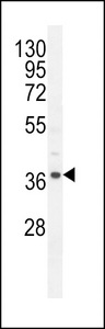 NDUFAF3 Antibody - NDUF3 Antibody western blot of mouse heart tissue lysates (35 ug/lane). The NDUF3 antibody detected the NDUF3 protein (arrow).