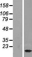NDUFAF3 Protein - Western validation with an anti-DDK antibody * L: Control HEK293 lysate R: Over-expression lysate