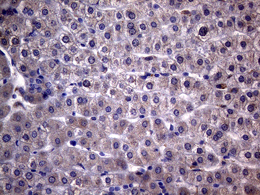 NDUFAF5 Antibody - Immunohistochemical staining of paraffin-embedded Human liver tissue within the normal limits using anti-NDUFAF5 mouse monoclonal antibody. (Heat-induced epitope retrieval by 1mM EDTA in 10mM Tris buffer. (pH8.5) at 120°C for 3 min. (1:2000)