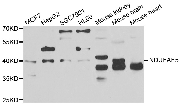 NDUFAF5 Antibody - Western blot analysis of extracts of various cell lines.