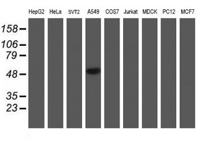 NDUFAF7 Antibody - Western blot of extracts (35 ug) from 9 different cell lines by using anti-C2orf56 monoclonal antibody.