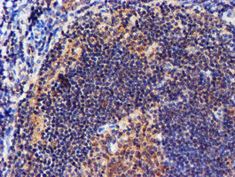 NDUFAF7 Antibody - IHC of paraffin-embedded Human tonsil using anti-C2orf56 mouse monoclonal antibody.