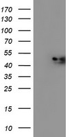 NDUFAF7 Antibody - HEK293T cells were transfected with the pCMV6-ENTRY control (Left lane) or pCMV6-ENTRY C2orf56 (Right lane) cDNA for 48 hrs and lysed. Equivalent amounts of cell lysates (5 ug per lane) were separated by SDS-PAGE and immunoblotted with anti-C2orf56.