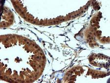 NDUFAF7 Antibody - IHC of paraffin-embedded Human breast tissue using anti-C2orf56 mouse monoclonal antibody.