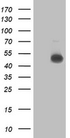 NDUFAF7 Antibody - HEK293T cells were transfected with the pCMV6-ENTRY control (Left lane) or pCMV6-ENTRY C2orf56 (Right lane) cDNA for 48 hrs and lysed. Equivalent amounts of cell lysates (5 ug per lane) were separated by SDS-PAGE and immunoblotted with anti-C2orf56.