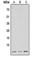 NDUFB1 / MNLL Antibody - Western blot analysis of NDUFB1 expression in HeLa (A); Raw264.7 (B); H9C2 (C) whole cell lysates.