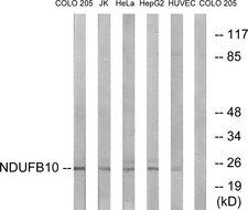 NDUFB10 Antibody - Western blot analysis of lysates from COLO, Jurkat, HeLa, HepG2, and HUVEC cells, using NDUFB10 Antibody. The lane on the right is blocked with the synthesized peptide.