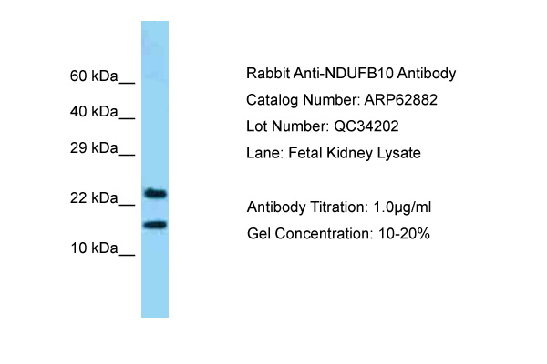 NDUFB10 Antibody -  This image was taken for the unconjugated form of this product. Other forms have not been tested.