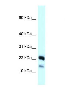 NDUFB10 Antibody - NDUFB10 antibody Western blot of 721_B Cell lysate. Antibody concentration 1 ug/ml.  This image was taken for the unconjugated form of this product. Other forms have not been tested.