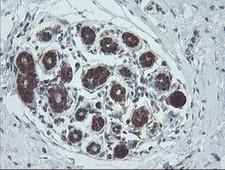 NDUFB10 Antibody - IHC of paraffin-embedded Human breast tissue using anti-NDUFB10 mouse monoclonal antibody.
