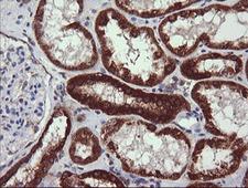 NDUFB10 Antibody - IHC of paraffin-embedded Human Kidney tissue using anti-NDUFB10 mouse monoclonal antibody. (Heat-induced epitope retrieval by 10mM citric buffer, pH6.0, 120°C for 3min).