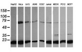 NDUFB10 Antibody - Western blot of extracts (35ug) from 9 different cell lines by using anti-NDUFB10 monoclonal antibody (HepG2: human; HeLa: human; SVT2: mouse; A549: human; COS7: monkey; Jurkat: human; MDCK: canine; PC12: rat; MCF7: human).
