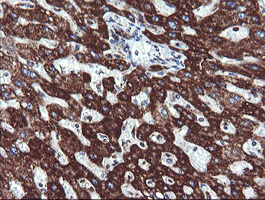 NDUFB10 Antibody - IHC of paraffin-embedded Human liver tissue using anti-NDUFB10 mouse monoclonal antibody. (Heat-induced epitope retrieval by 10mM citric buffer, pH6.0, 120°C for 3min).