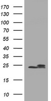 NDUFB10 Antibody - HEK293T cells were transfected with the pCMV6-ENTRY control (Left lane) or pCMV6-ENTRY NDUFB10 (Right lane) cDNA for 48 hrs and lysed. Equivalent amounts of cell lysates (5 ug per lane) were separated by SDS-PAGE and immunoblotted with anti-NDUFB10.